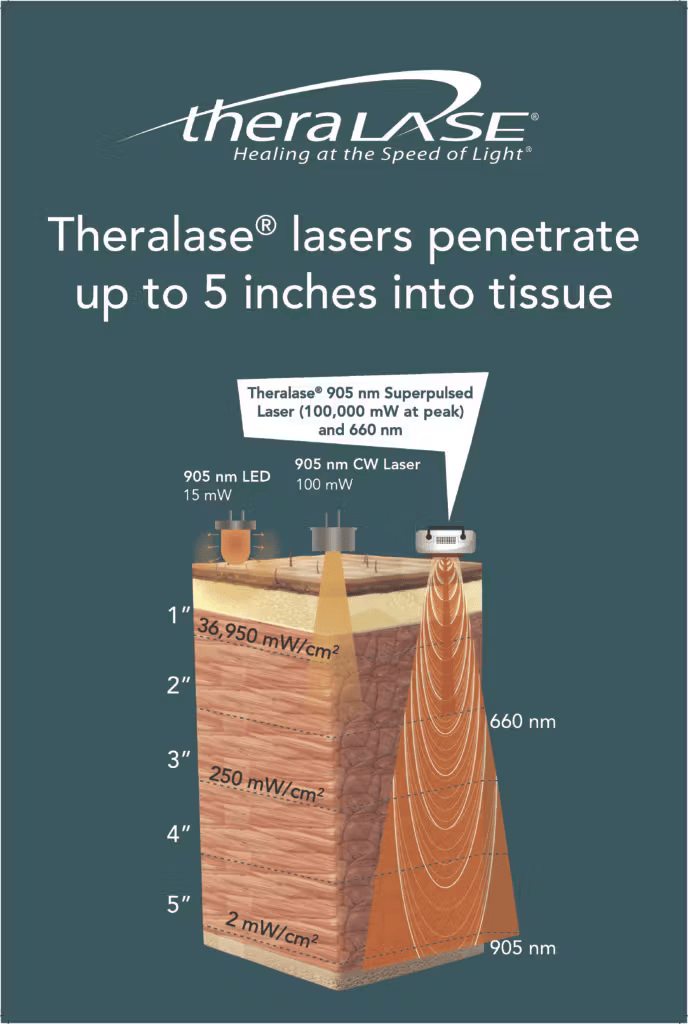 poster 24x36in penetrationdepth 2017oct pdf 688x1024 1